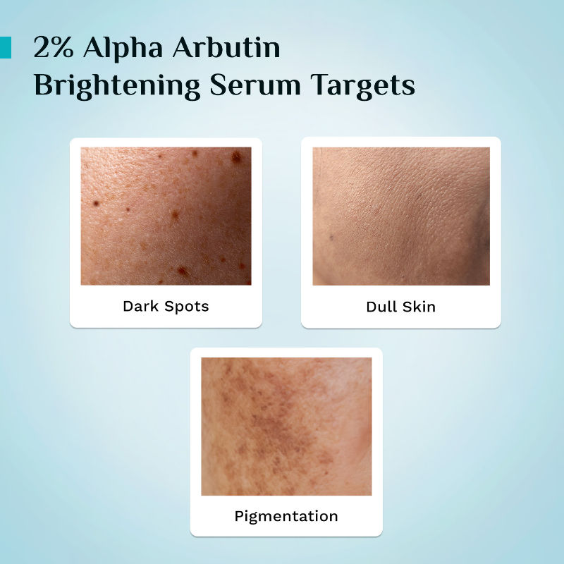 Pilgrim 2% Alpha Arbutin & 3% Vitamin C Brightening Serum, Fades Pigmentation & Brightens Skin