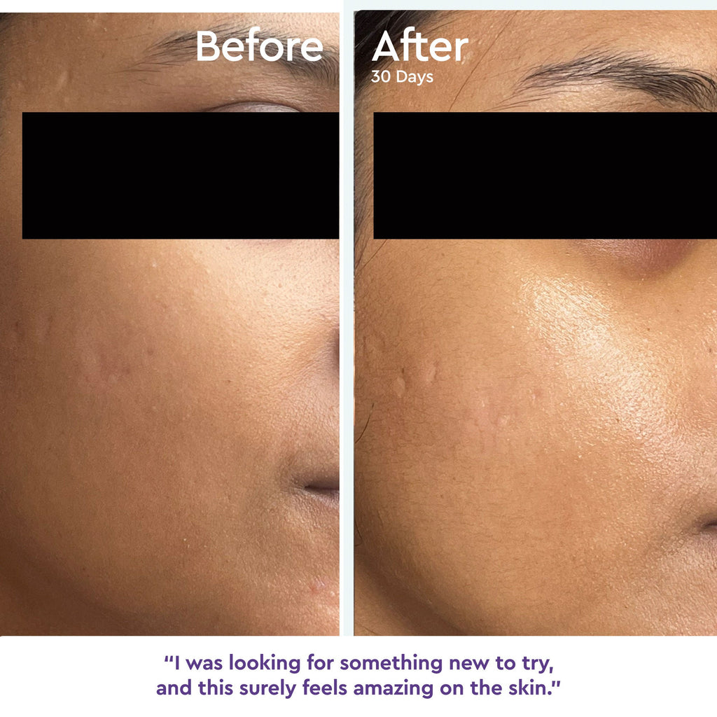Within Beauty Ceramide & Hyaluronic Acid Gel Moisturiser, Daily Dew Barrier Restore Moisturiser