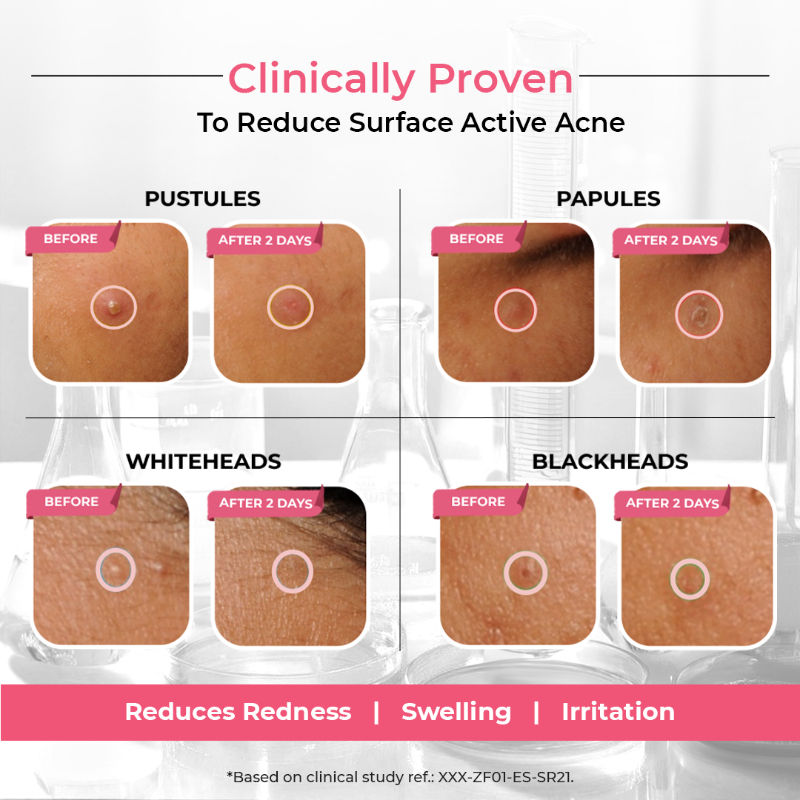 The Pink Foundry Overnight Acne Spot Corrector