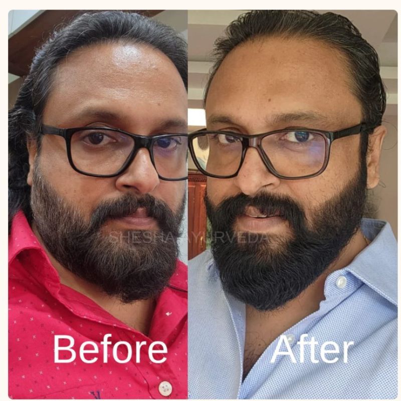Shesha Ayurveda Beard Color For Men - Natural Black