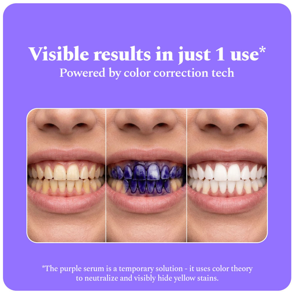 Perfora Purple Magic Teeth Whitening Serum