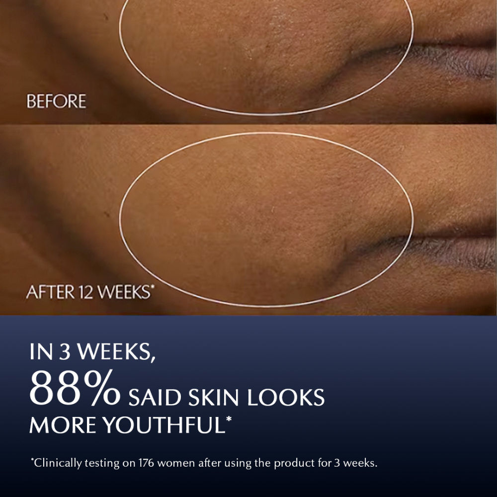 Estee Lauder Advanced Night Repair Synchronized Multi-Recovery Complex With Hyaluronic Acid (Serum)