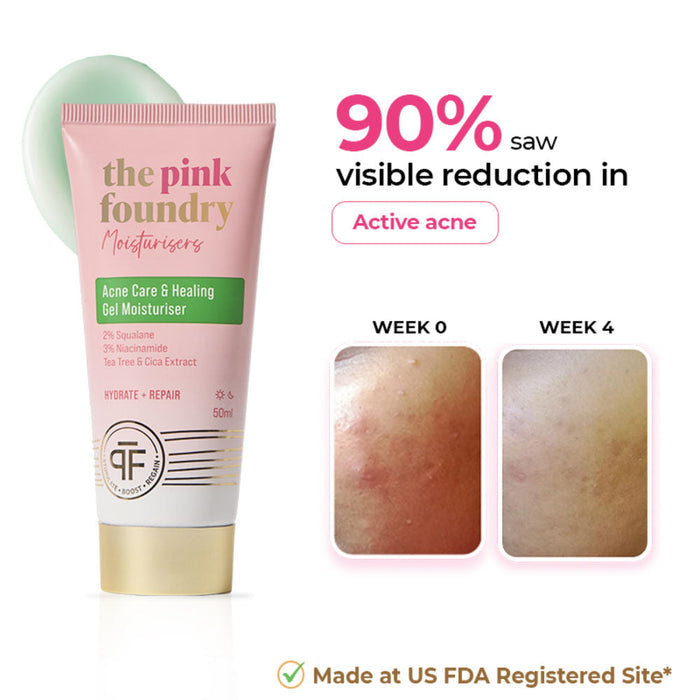 The Pink Foundry Acne Moisturiser 2% Squalane & 3% Niacinamide Oil Free Hydration & Acne Prevention