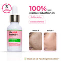 The Pink Foundry Acne & Oil Control Intense Face Serum with 2% Salicylic Acid