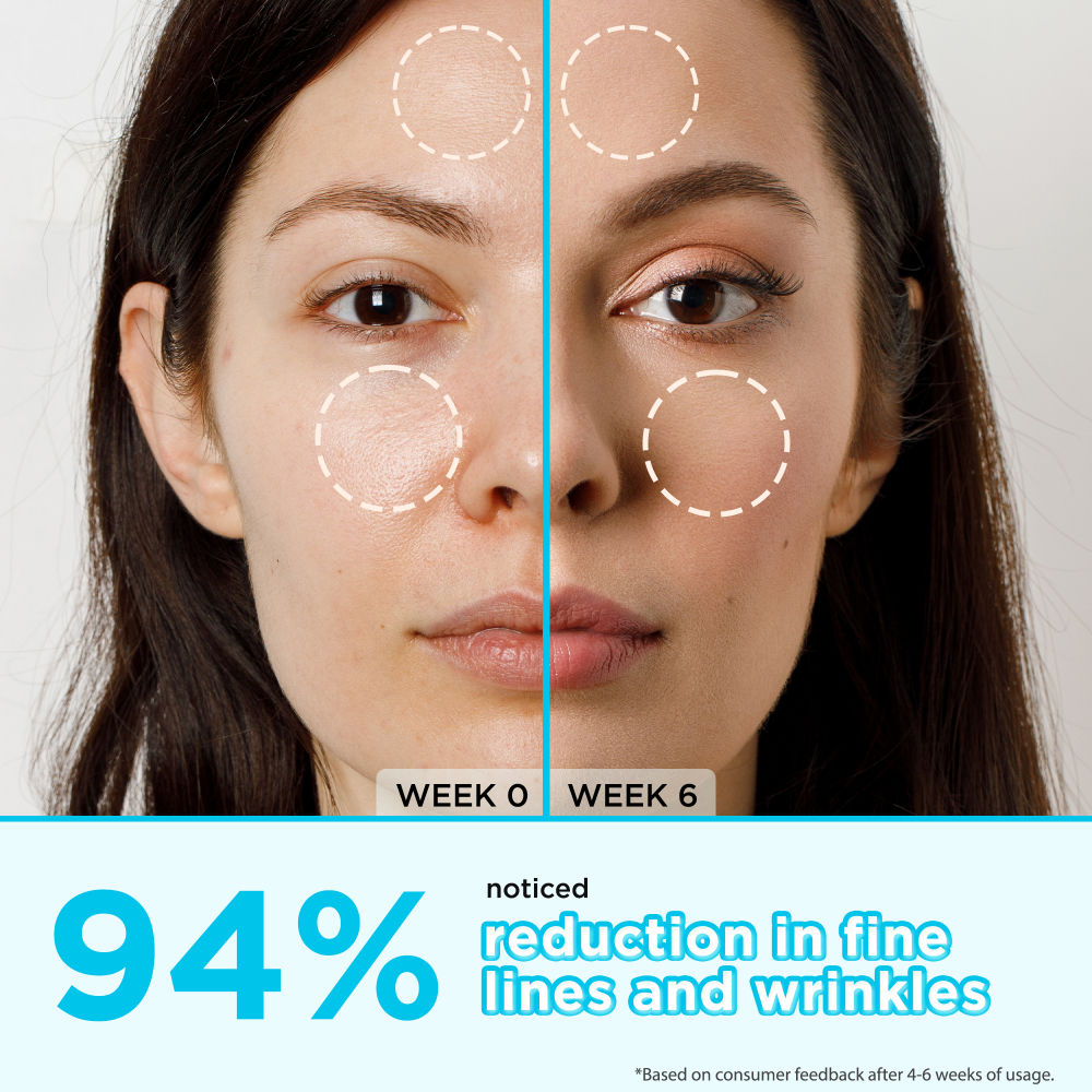 Orgatre Retinol Anti-Aging Face Serum - Reduces Fine Lines, Boosts Collagen, Hydrates & Skin Firming