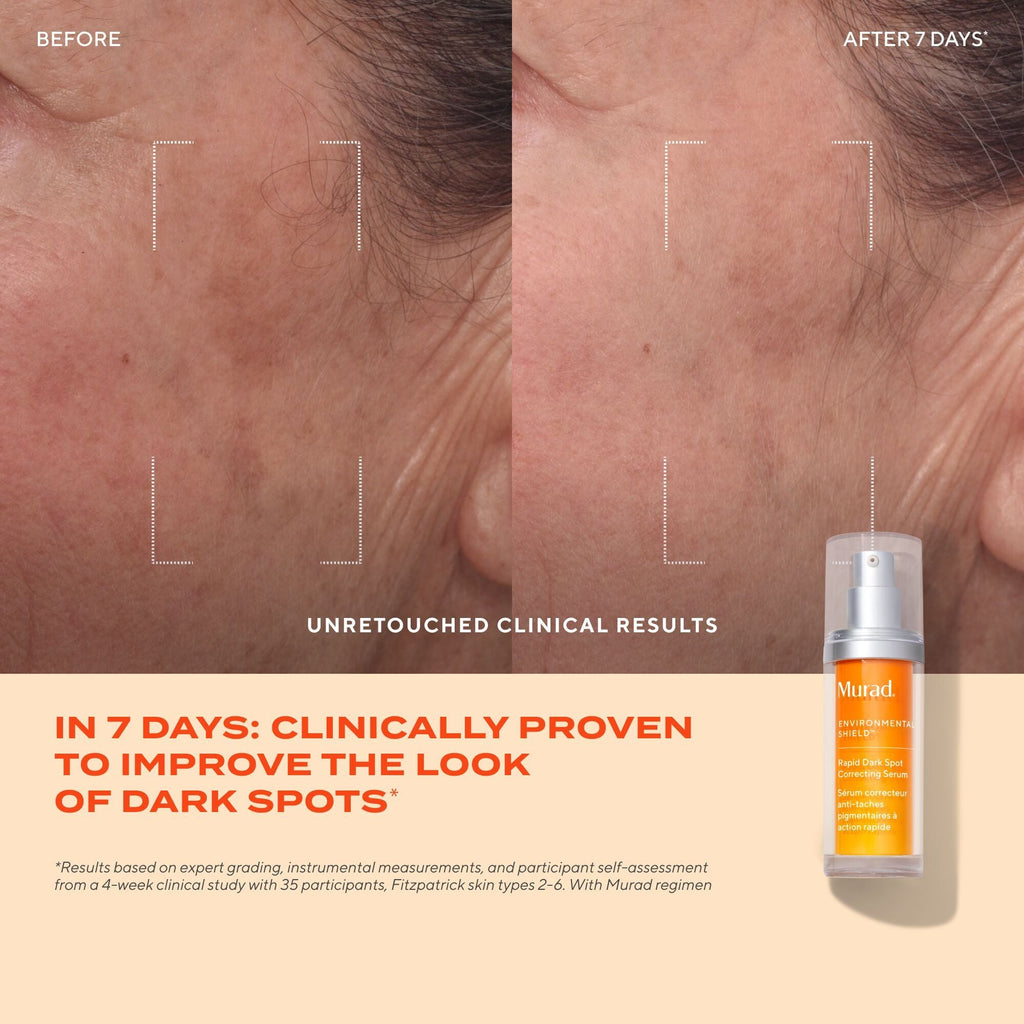 Murad Rapid Dark Spot Correcting Serum