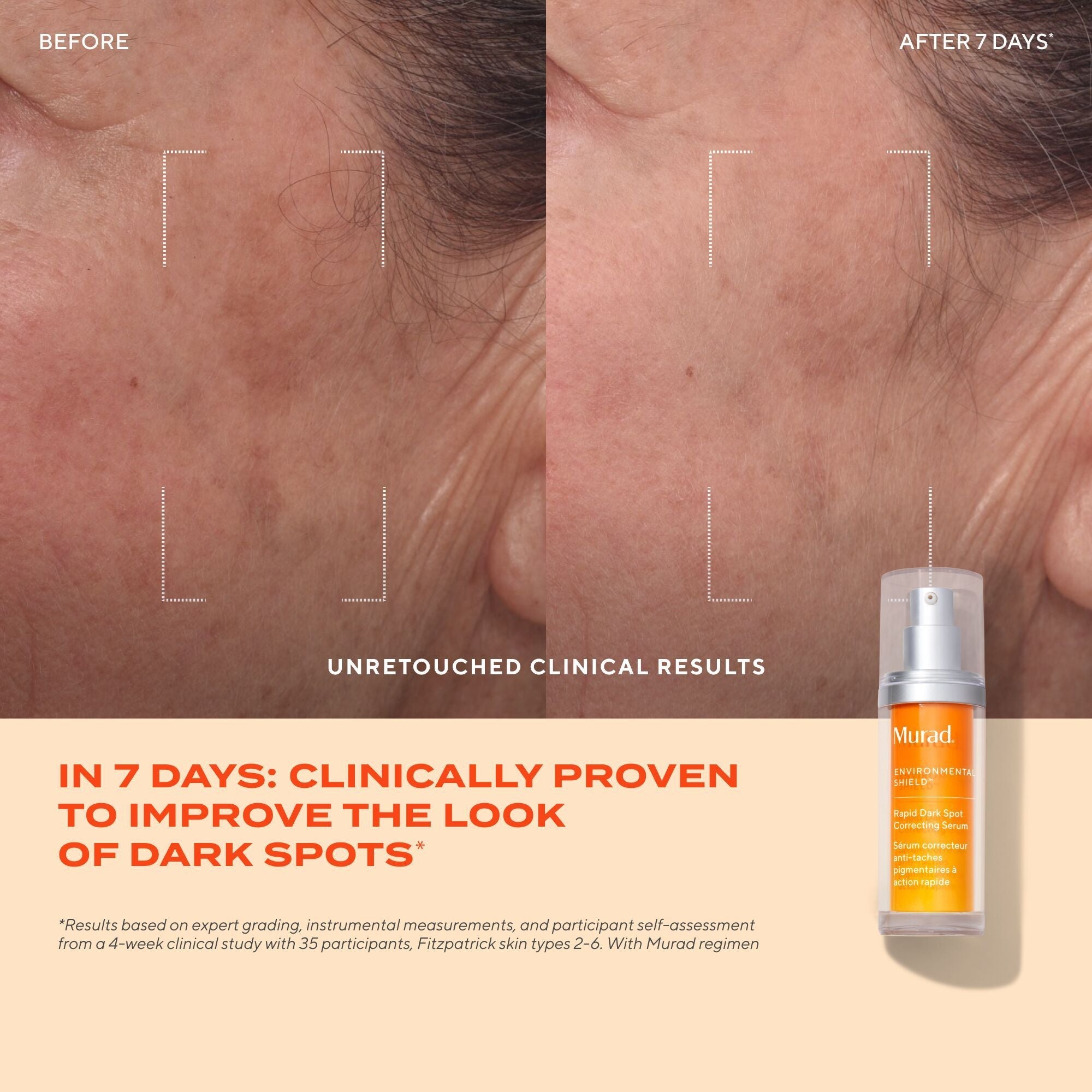 Murad Rapid Dark Spot Correcting Serum
