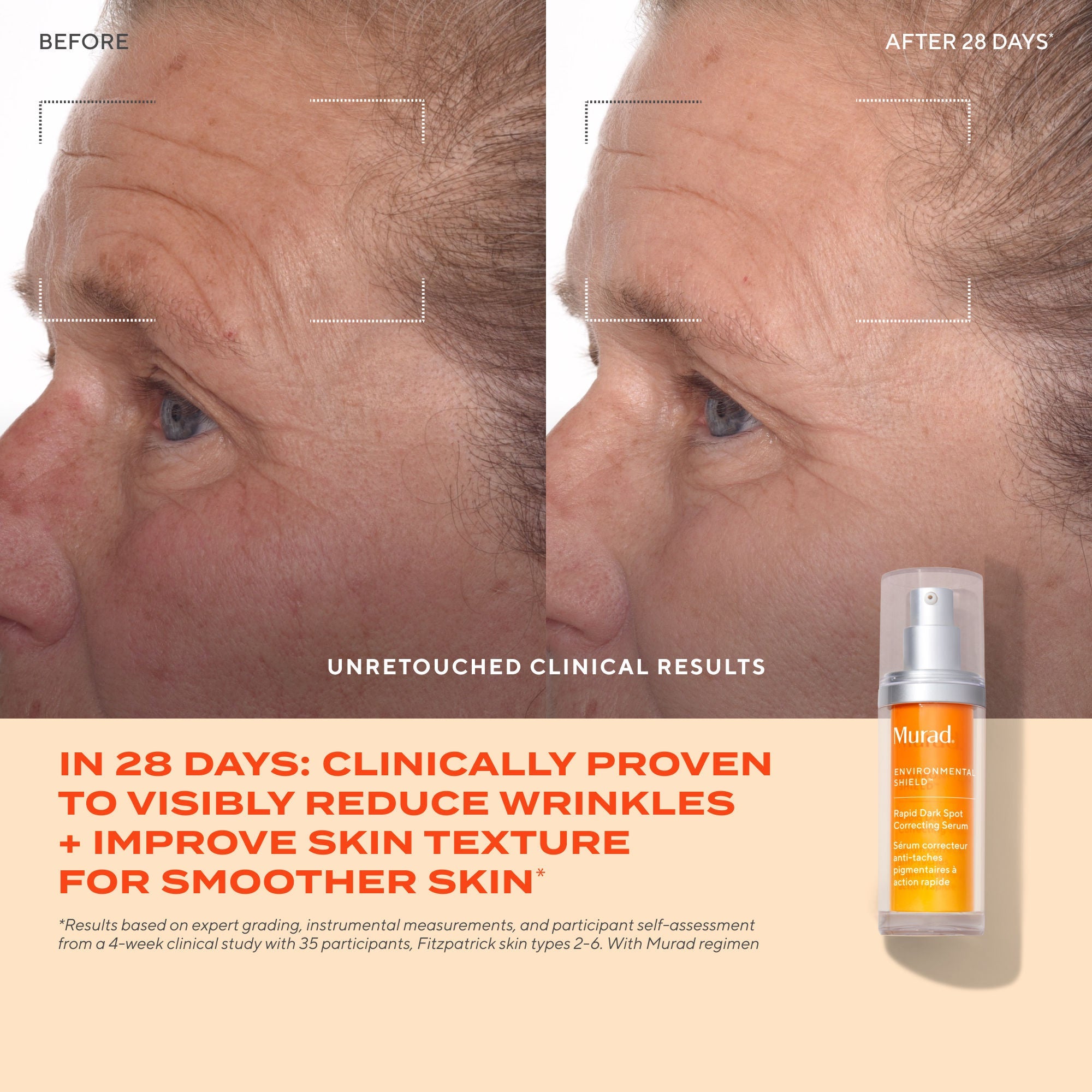 Murad Rapid Dark Spot Correcting Serum