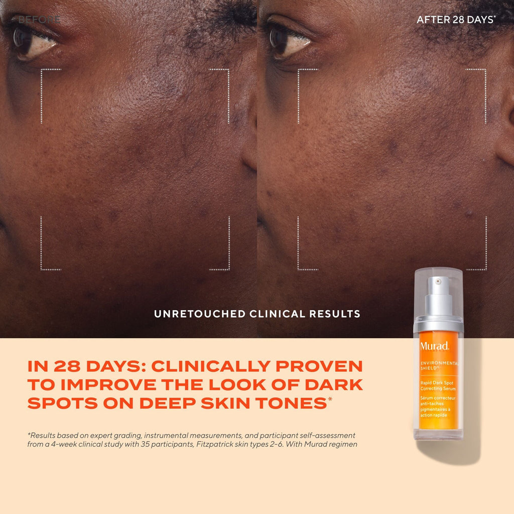 Murad Rapid Dark Spot Correcting Serum