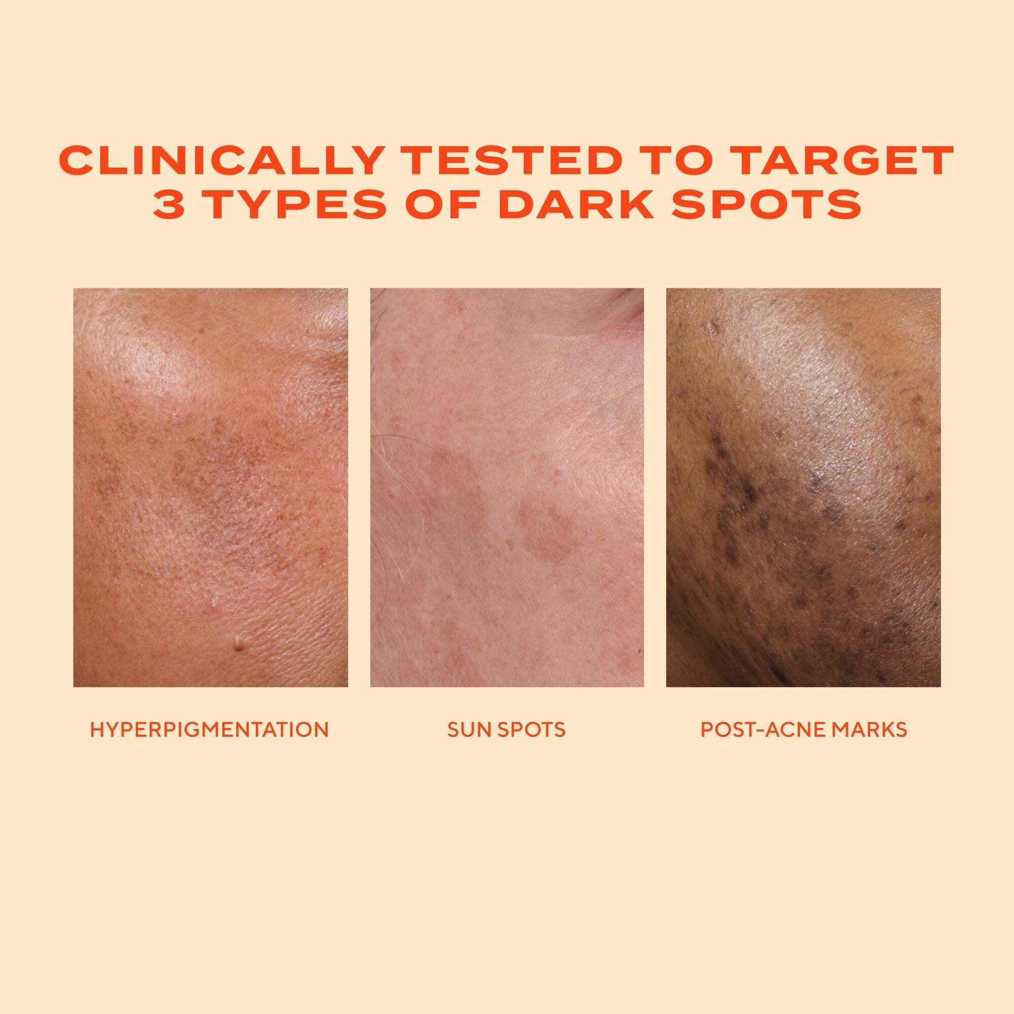 Murad Rapid Dark Spot Correcting Serum