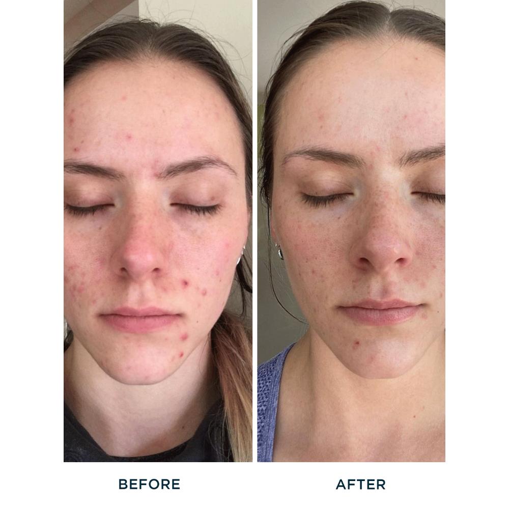 Fre Purify Me Hydrating Facial Cleanser