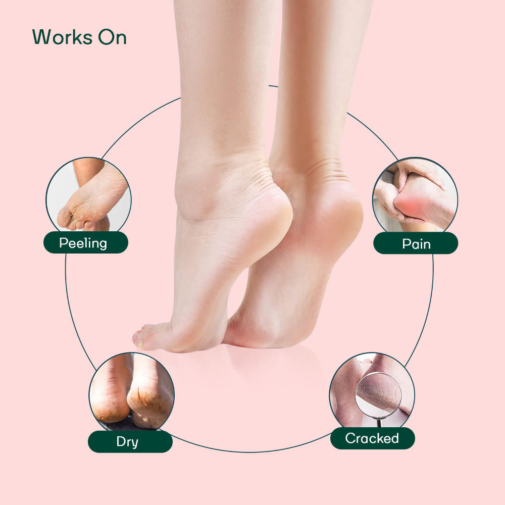 MOUNTAINOR Silicone Gel Heel Socks For Dry Hard Cracked Heel Repair Pad - Pink, Blue & Grey