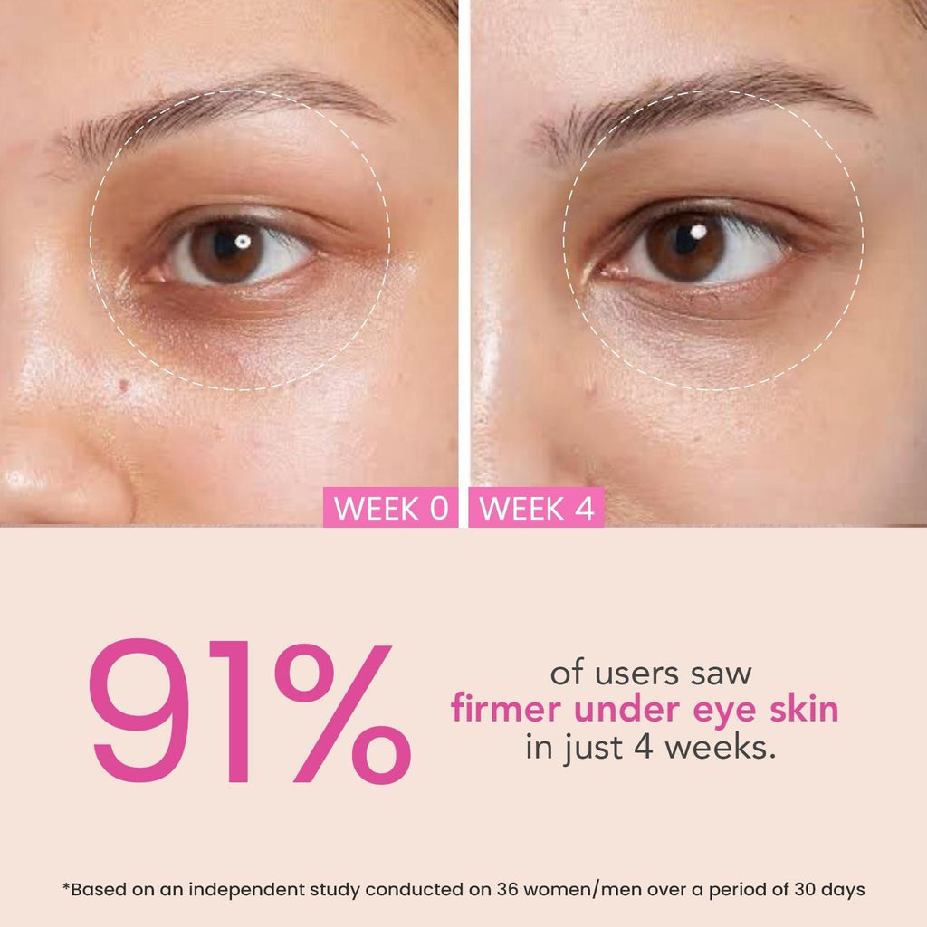 O3+ Eye Circle Brightening & Whitening Under Eye Cream