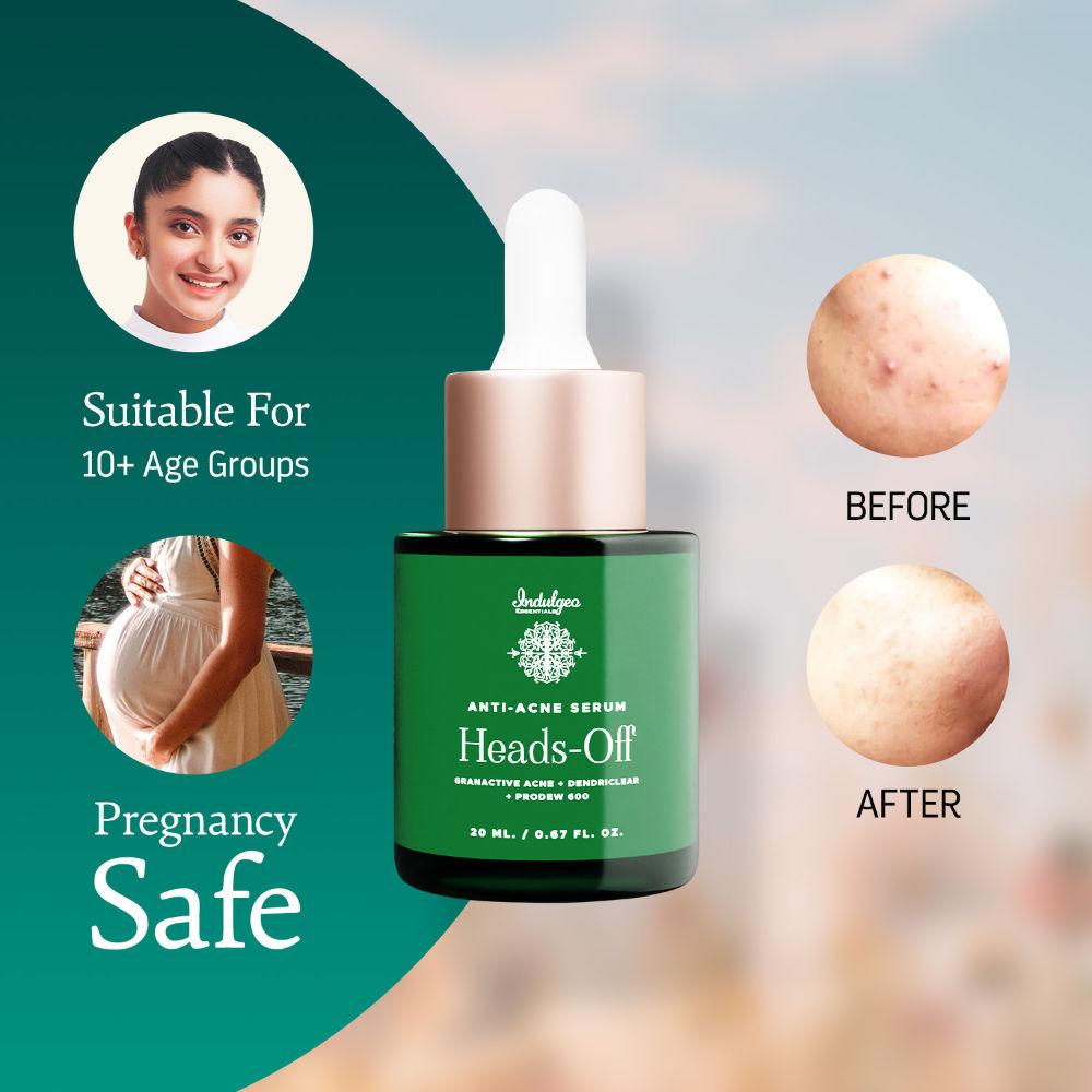 Indulgeo Essentials Heads Off Anti Acne Face Serum