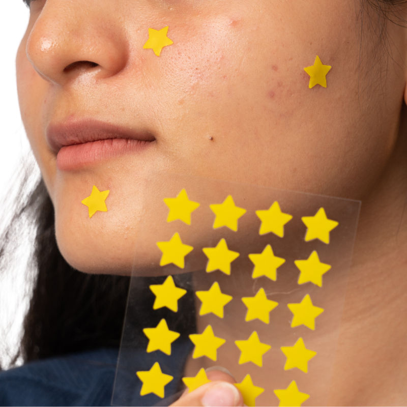 Gush Beauty Dart It Pimple Patches Work in 6-8 Hrs For Acne, Zits And Blemishes - Super Star