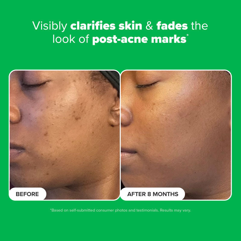 Paula's Choice Boost 10% Azelaic Acid Booster