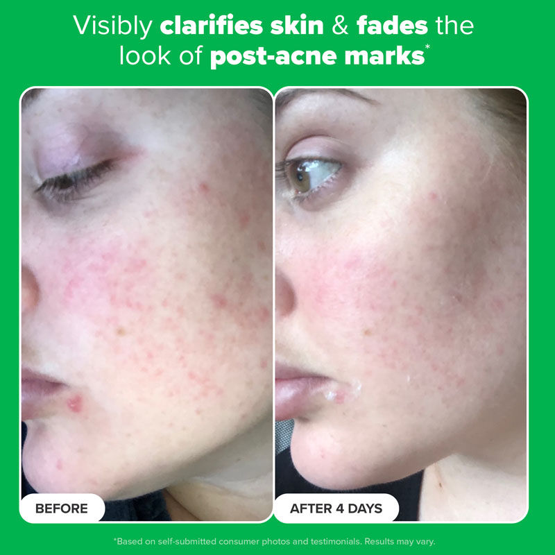 Paula's Choice Boost 10% Azelaic Acid Booster