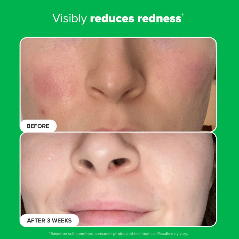 Paula's Choice Boost 10% Azelaic Acid Booster