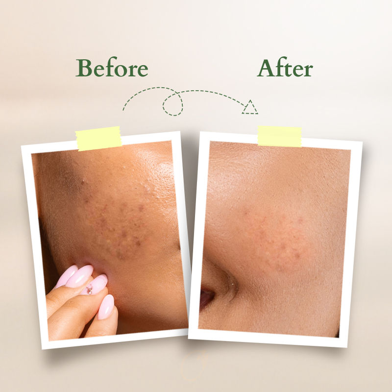 Lotus Organics Vit-C Radiance Booster Serum - Lemon Verbena