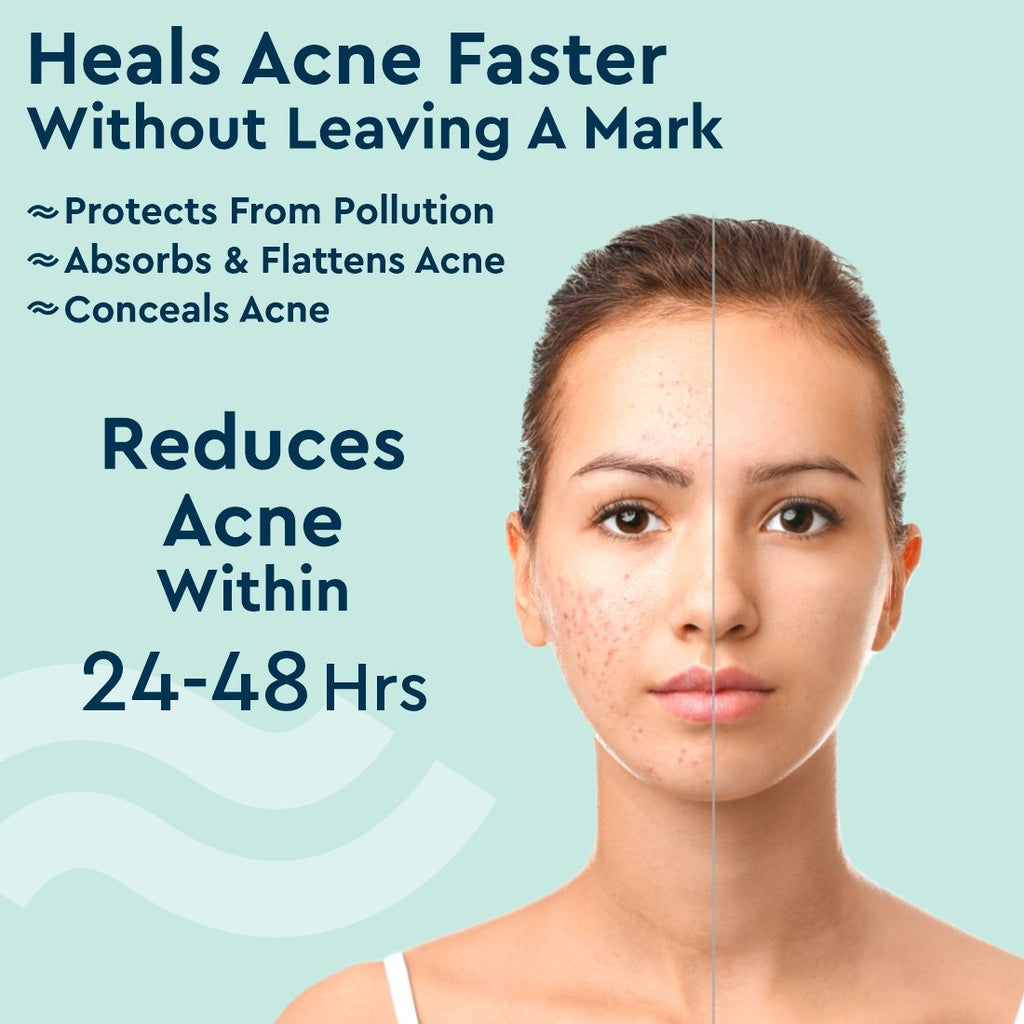 GUBB Acne Patches