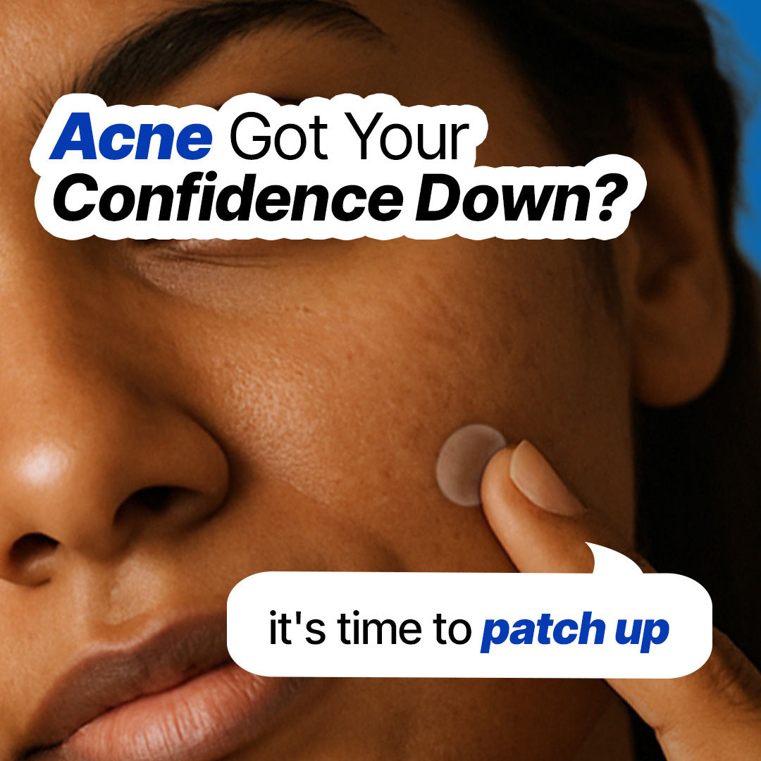 Sotrue Acne Patches With Salicylic Acid And Hydrocolloid For Clean & Clear Skin - 20 Patches