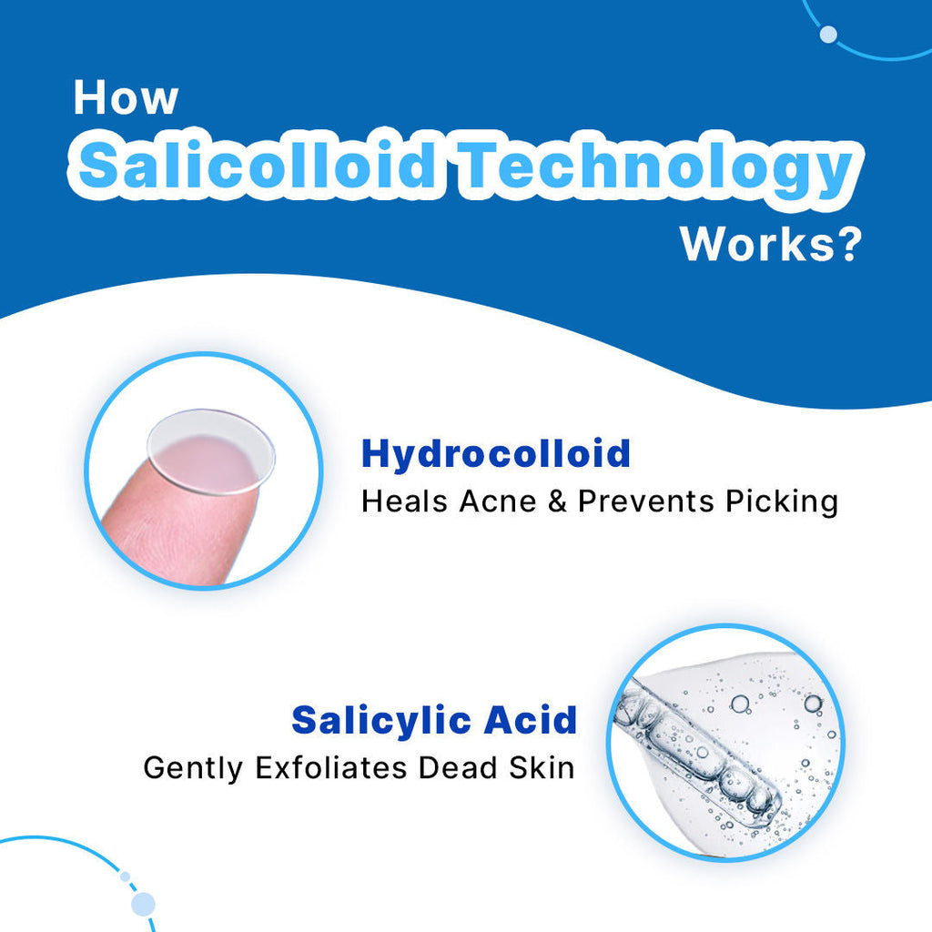Sotrue Acne Patches With Salicylic Acid And Hydrocolloid For Clean & Clear Skin - 20 Patches