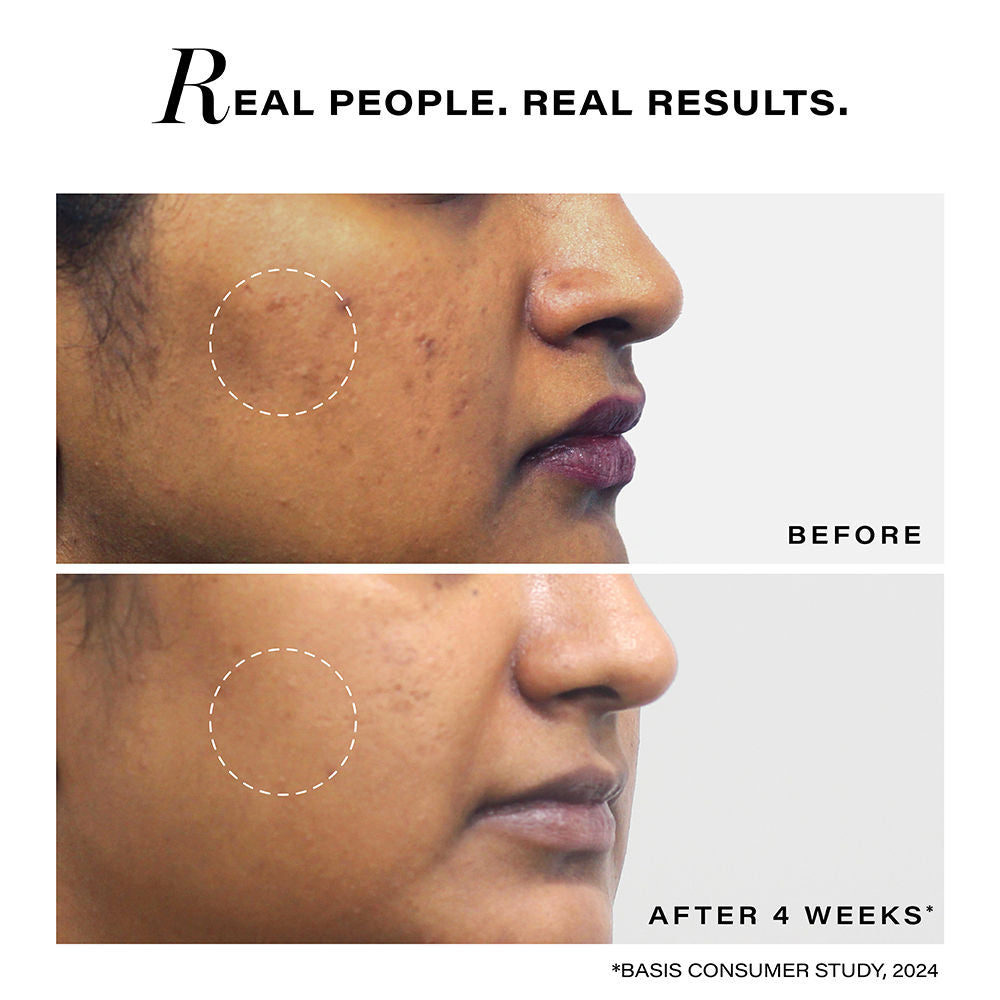 Novology Pigmentation Reduction Moisturiser For Dark Spots, Acne Marks And Uneven Skin Tone