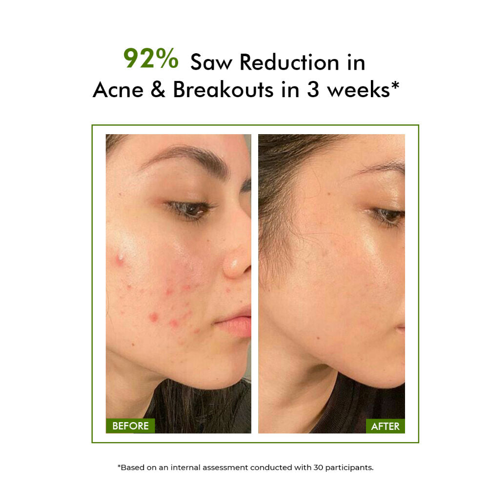Conscious Chemist Salicylic Acid Face Wash For Oily Acne Prone Skin With Glycolic Acid &CICA Extract