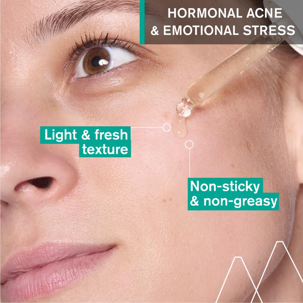 Uriage Hyseac Skin Anti-Blemish Serum 5.8% AHA for Hormonal Peak & Stress Acne Dermat Recommended