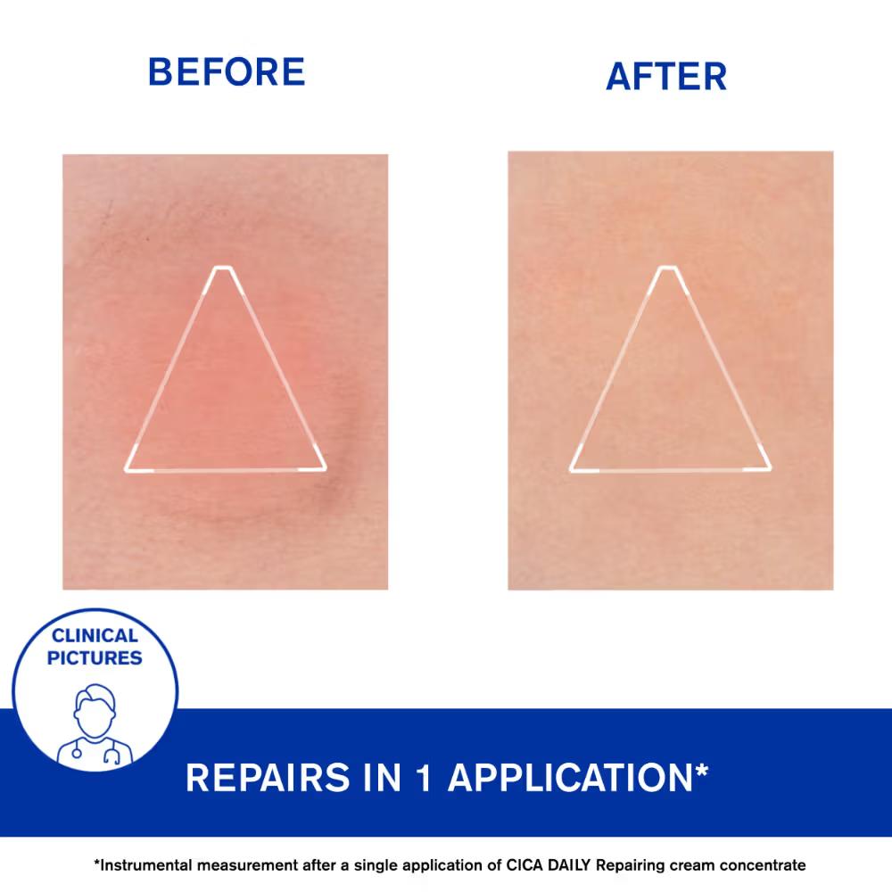Uriage Cica-Daily Repairing Gel Face Cream Rejuvenates Skin Centella Asiatica Hyaluronic Acid Cu-Zn
