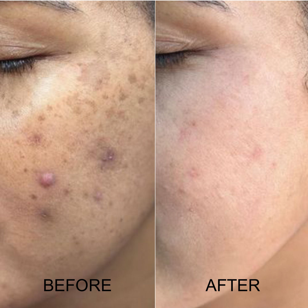 Richfeel Skin Lightening Lotion - Reduces Pigmentation, Lightens Spots & Tan, Non-Oily Base