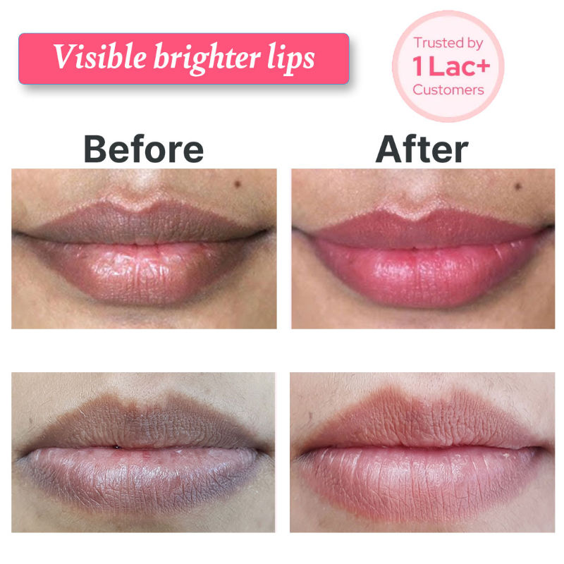 ALANNA Lip Wash Lip Brightening, Lip Cleanser, For Dark & Dry Pigmented Lips For Women