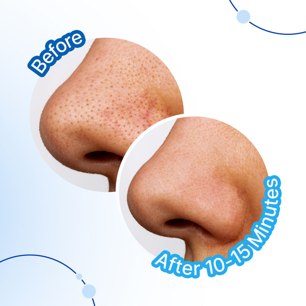Sotrue Charcoal Nose Pore Deep Cleansing Strips For Blackheads & Whiteheads Removal