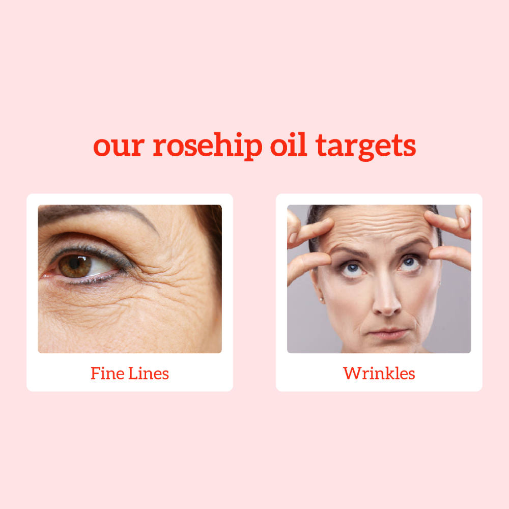 inatur Rosehip Oil, 100% Pure & Cold Pressed, Moisturizing, Anti-Aging & Hydrating Facial Oil