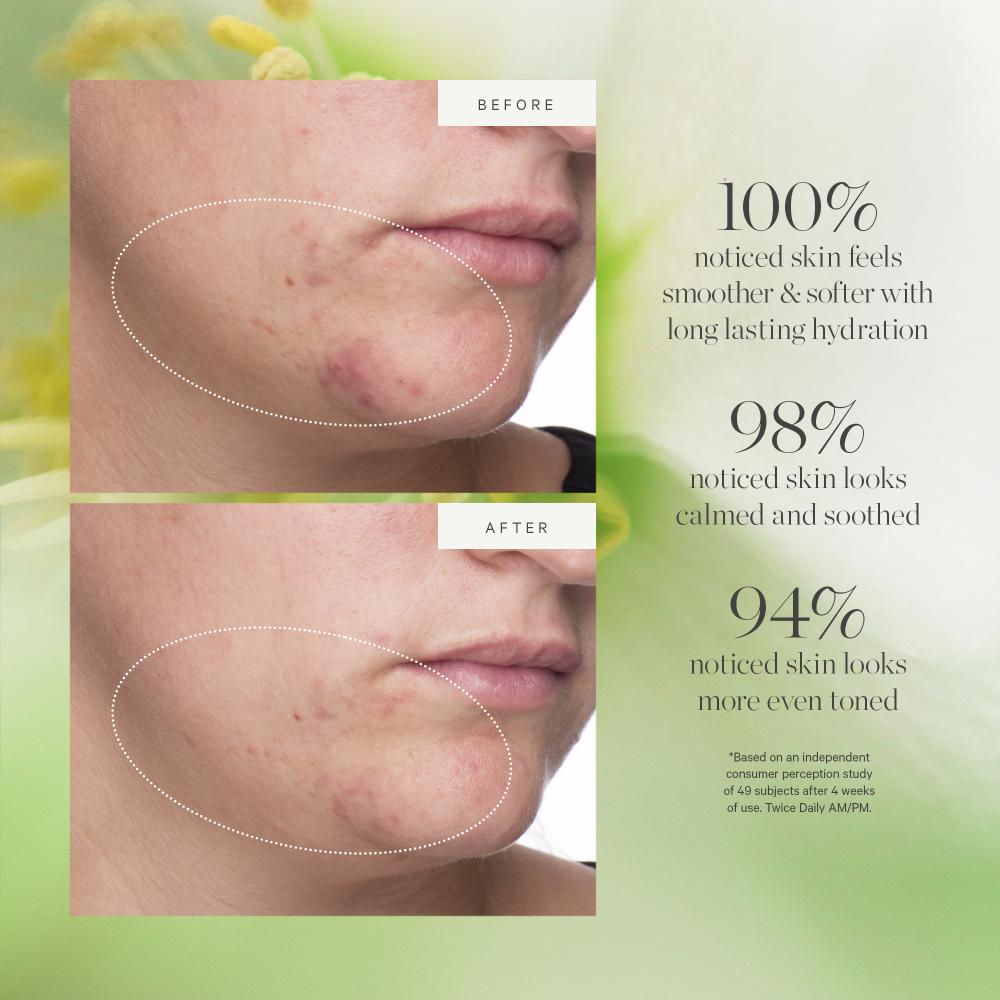 Kora Organics Active Algae Moisturizer- Reduces Dullness Fine Lines Pores With Green Algae Green Tea
