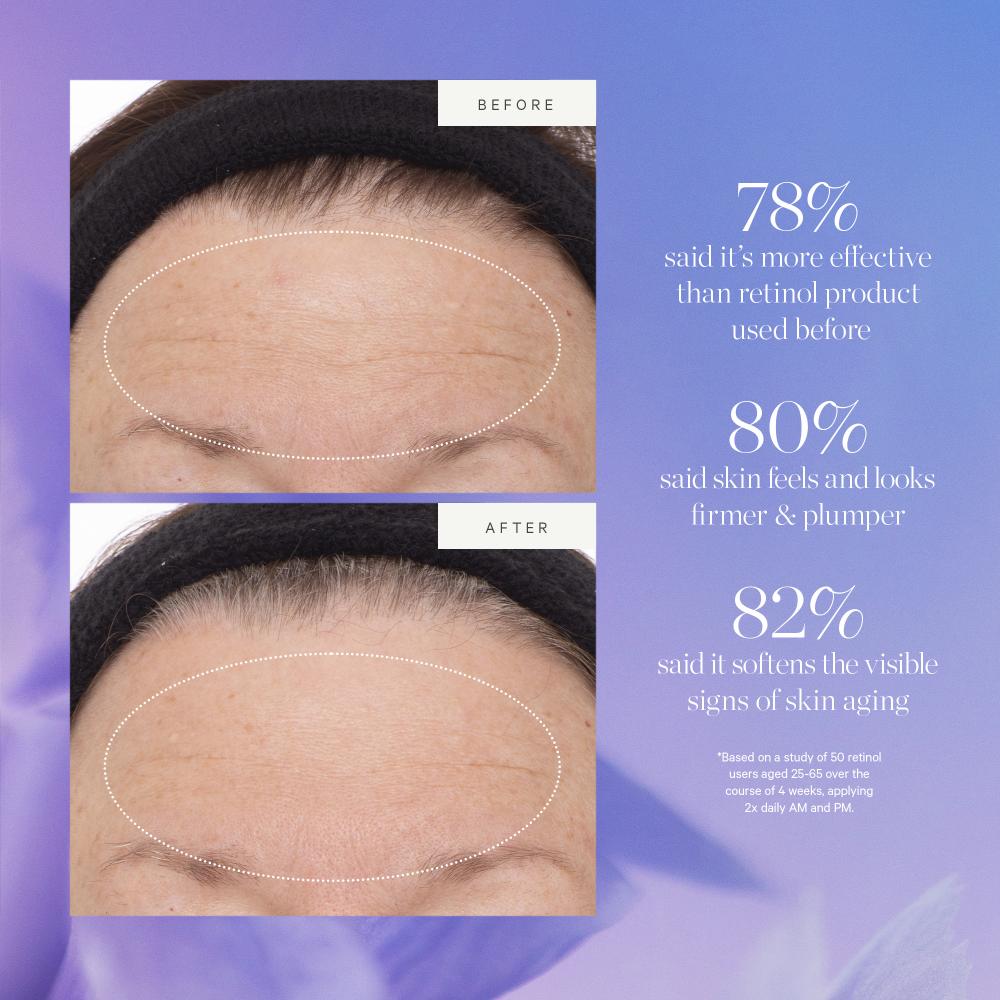 Kora Organics Plant Stem Cell Retinol Alternative Serum Firms Smooths Protect With Bakuchiol Rosehip