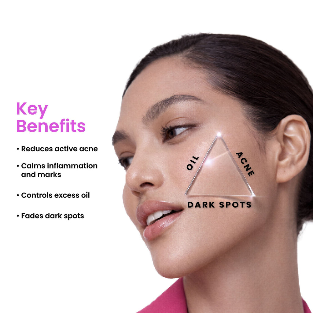 Foxtale 12% Niacinamide Brightening Face Serum, Fades Dark Spots, Acne marks & Oil Control