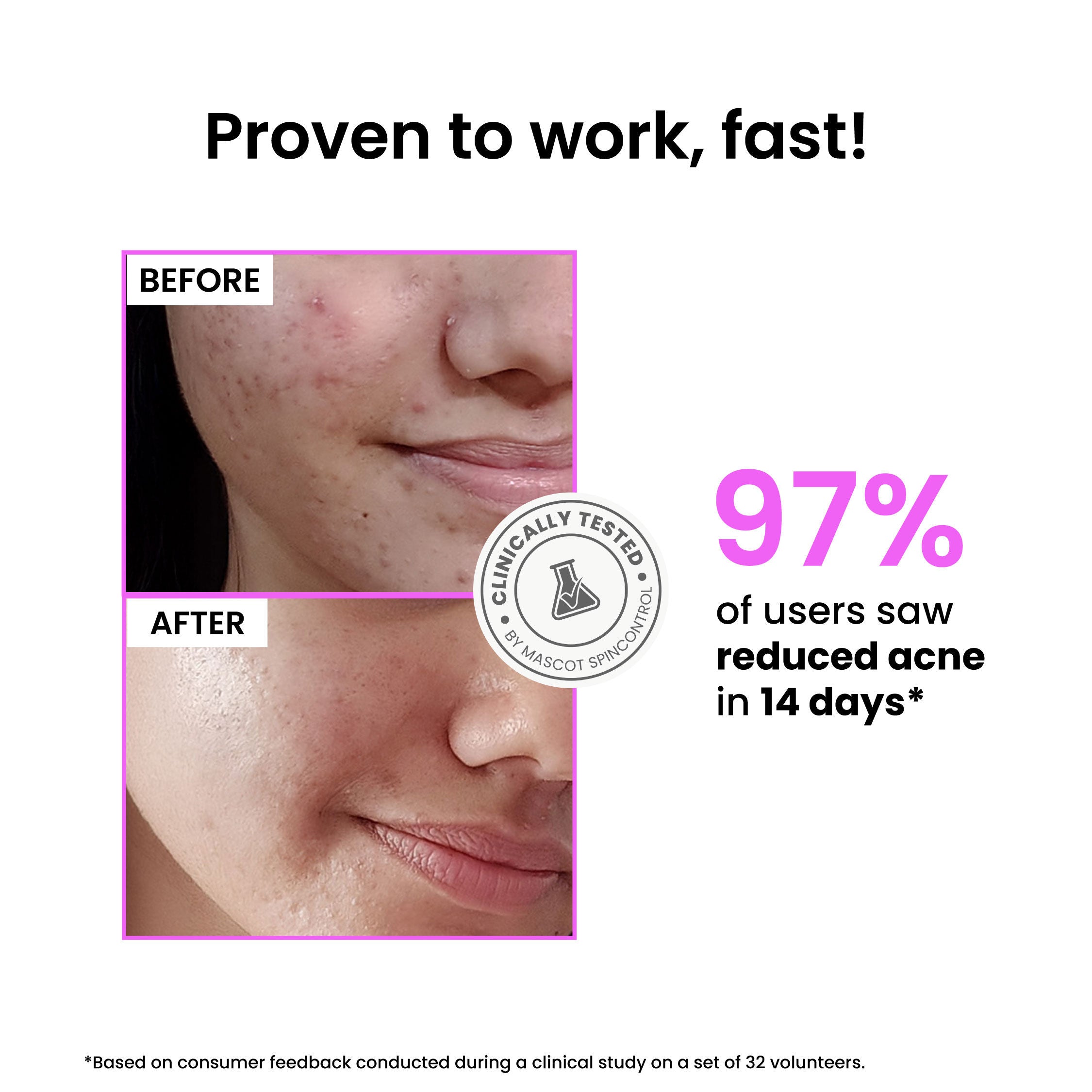 Foxtale 12% Niacinamide Brightening Face Serum, Fades Dark Spots, Acne marks & Oil Control