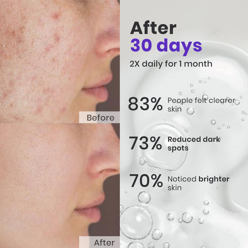 Saffrn Face Spot Corrector