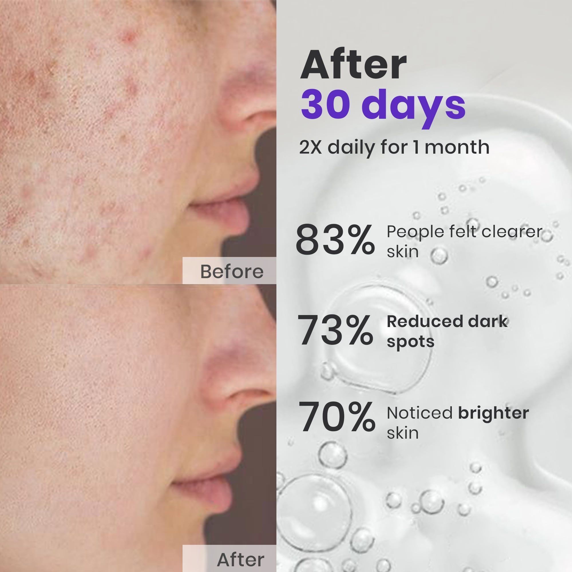 Saffrn Face Spot Corrector