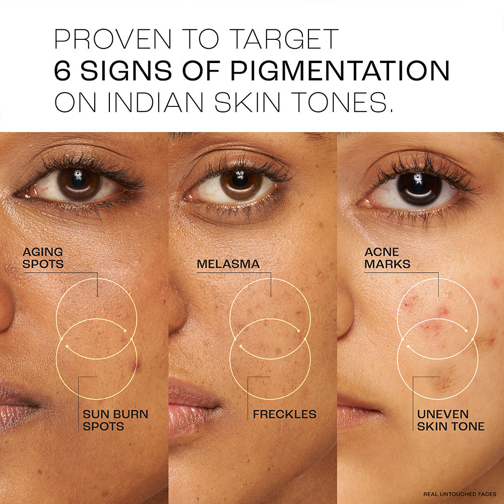 Lakme Absolute Perfect Radiance Serum With 7% Pure Niacinamide For 2X Skin Brightening
