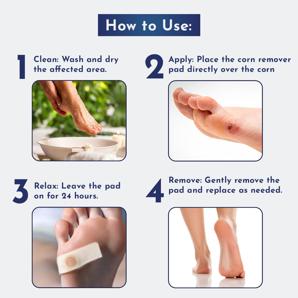 Wipness Natural Foot Corn Removal Plaster 20 Strips