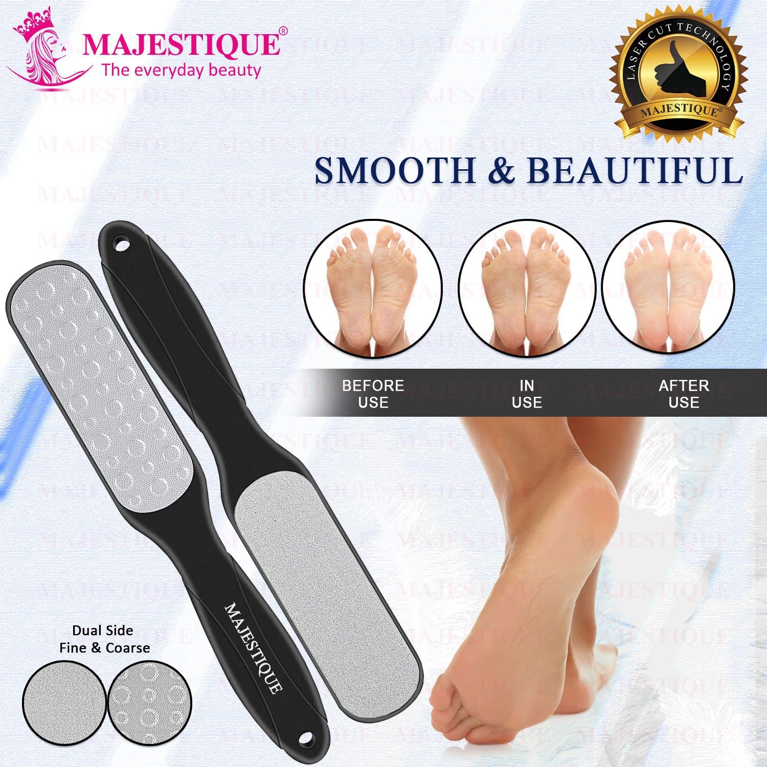 Majestique Callus Remover Foot Scrubber for Pedicure Spa Treatment - Color May Vary