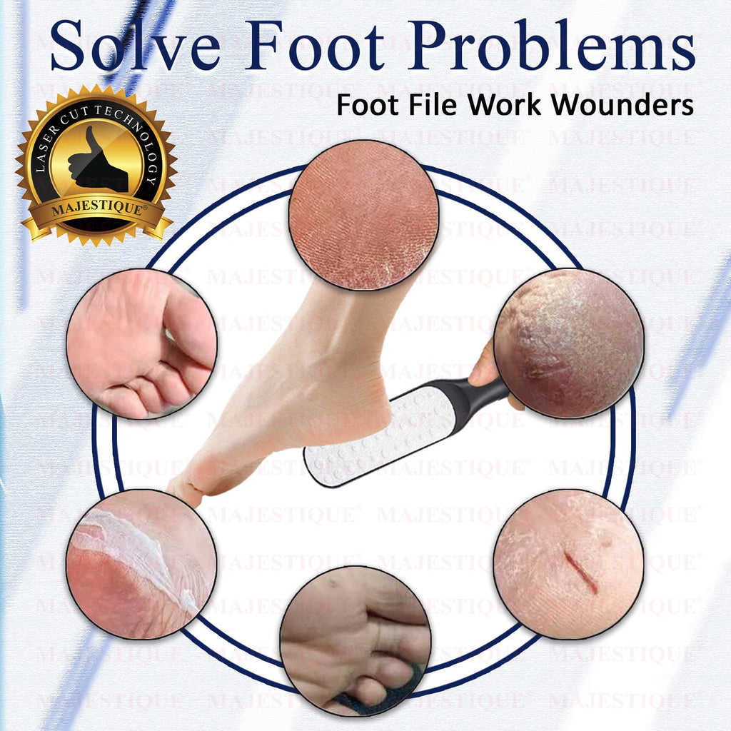 Majestique Callus Remover Foot Scrubber for Pedicure Spa Treatment - Color May Vary