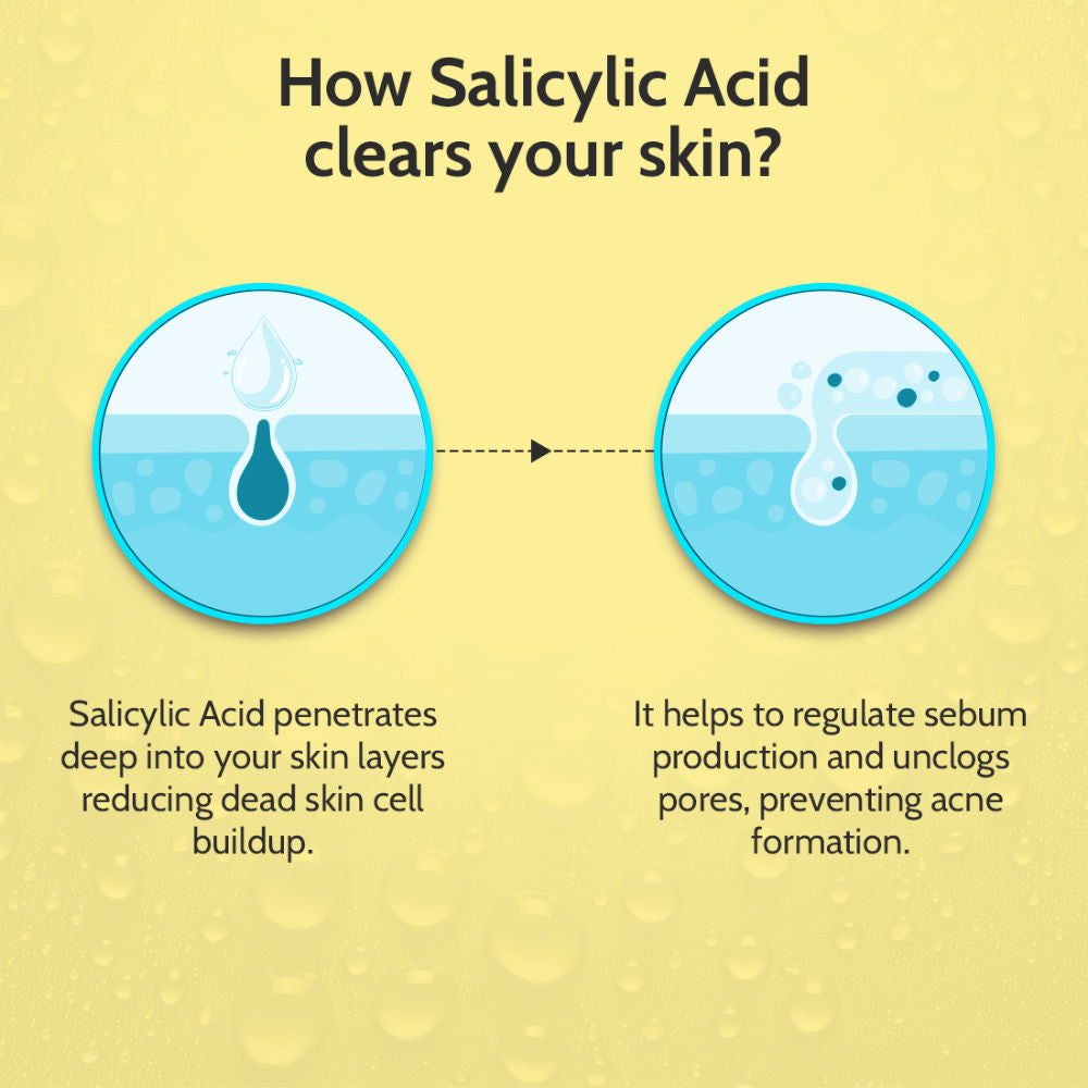 Chemist at Play 2% Salicylic Acid Face Serum Treats Active Acne, Controls Excess Oil