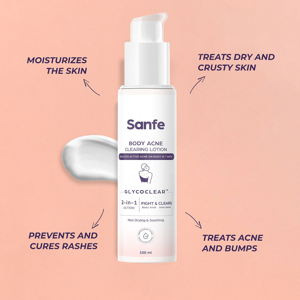 Sanfe Back & Bum Acne Clearing Lotion with Shea Butter & Peach Extracts
