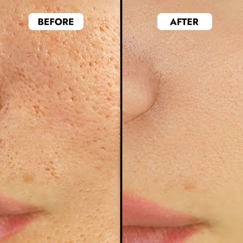 Cos-IQ Niacinamide Vitamin B3-5 Face Serum