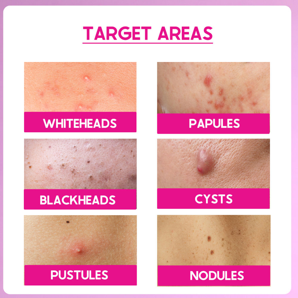 Cos-IQ Peel ABP-22% Exfoliate AHA + BHA + PHA Beginner Friendly Serum