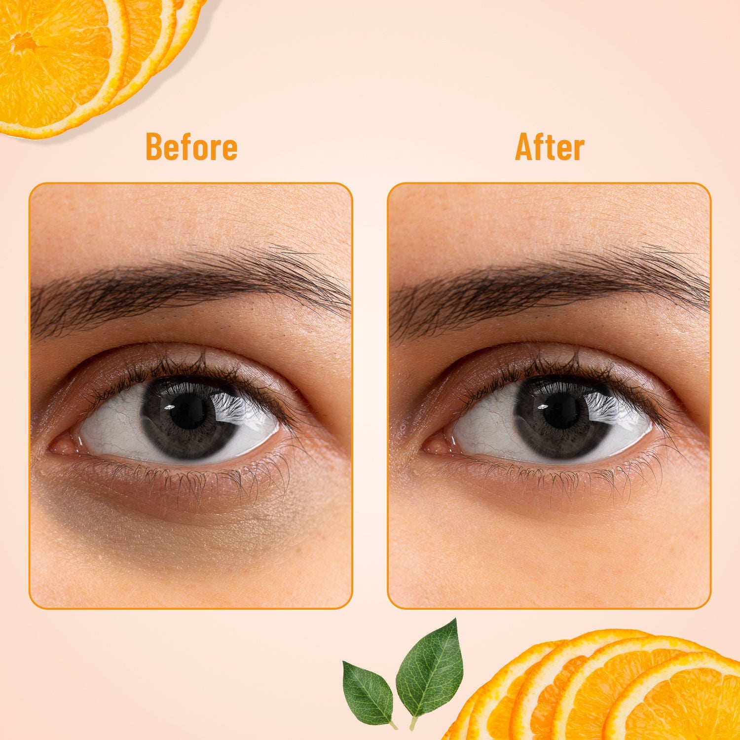 Swiss Beauty Hydra Eye Serum Patches For Dark Circles And Puffiness , Hydrate Skin