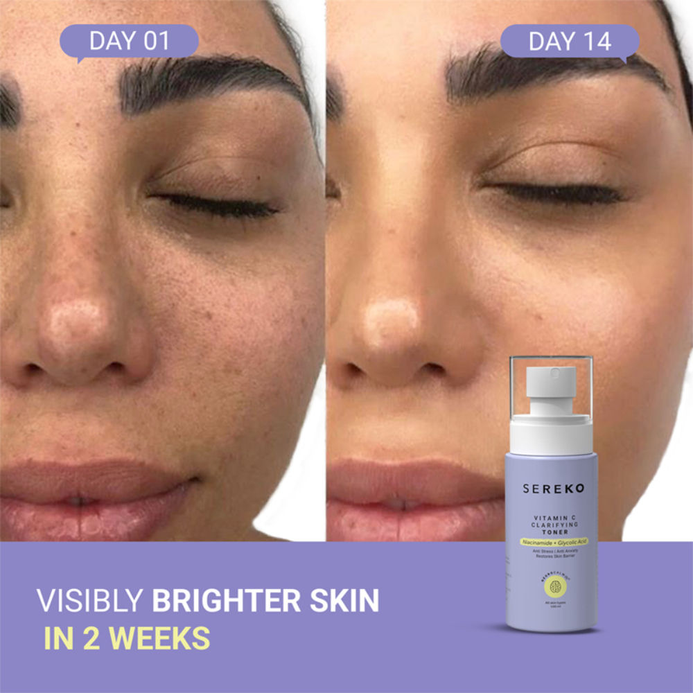 Sereko Vitamin C Clarifying Face Toner With Niacinamide For Brightening & Tighten Pores